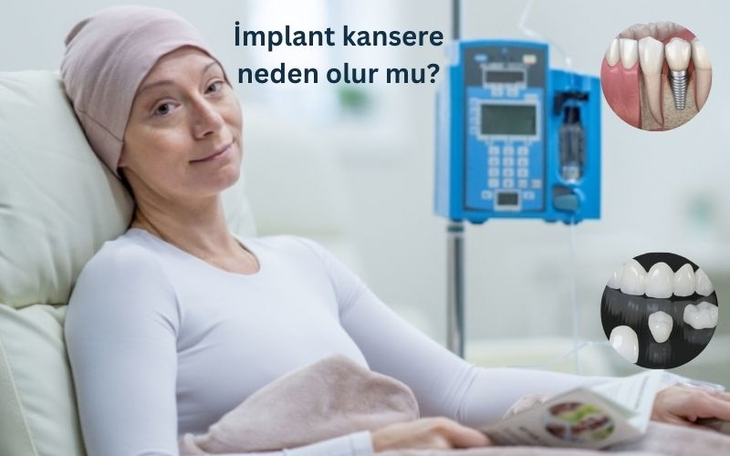 İmplant kanser yapar mı?