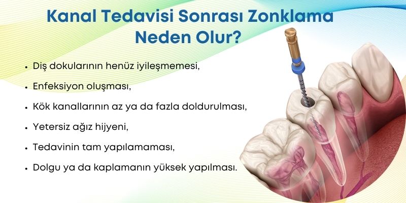 Kanal tedavisi sonrası zonklama neden olur? Antalya