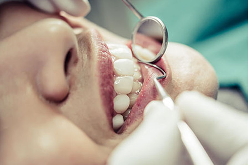 diş implantı 