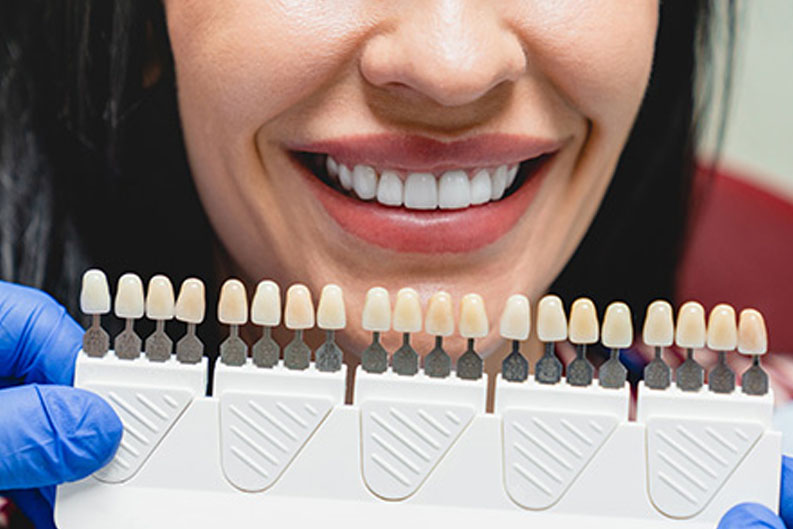 Estetik Diş Hekimliği- Diş Kaplama Antalya